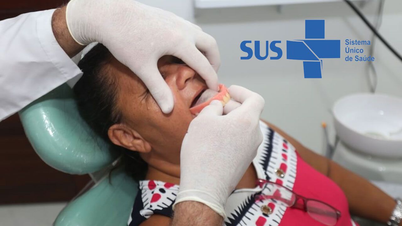 Implante dentário gratuito pelo SUS? Descubra como agora!